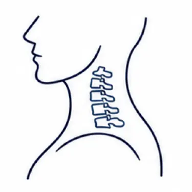 fisioterapia cervical